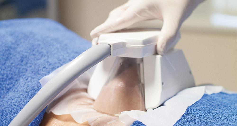 How Fat Freezing and HIFU Work Together? 2 Multiple Areas in One Session HIFU and Fat Freezing Nazeing
