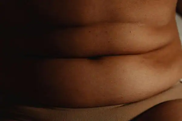The Hidden Connection: How Stress Shapes Your Fitness and Body Composition 3 image of what stress can do on the stomach area and how Lipo 360 Nazeing can help to change your body shape.