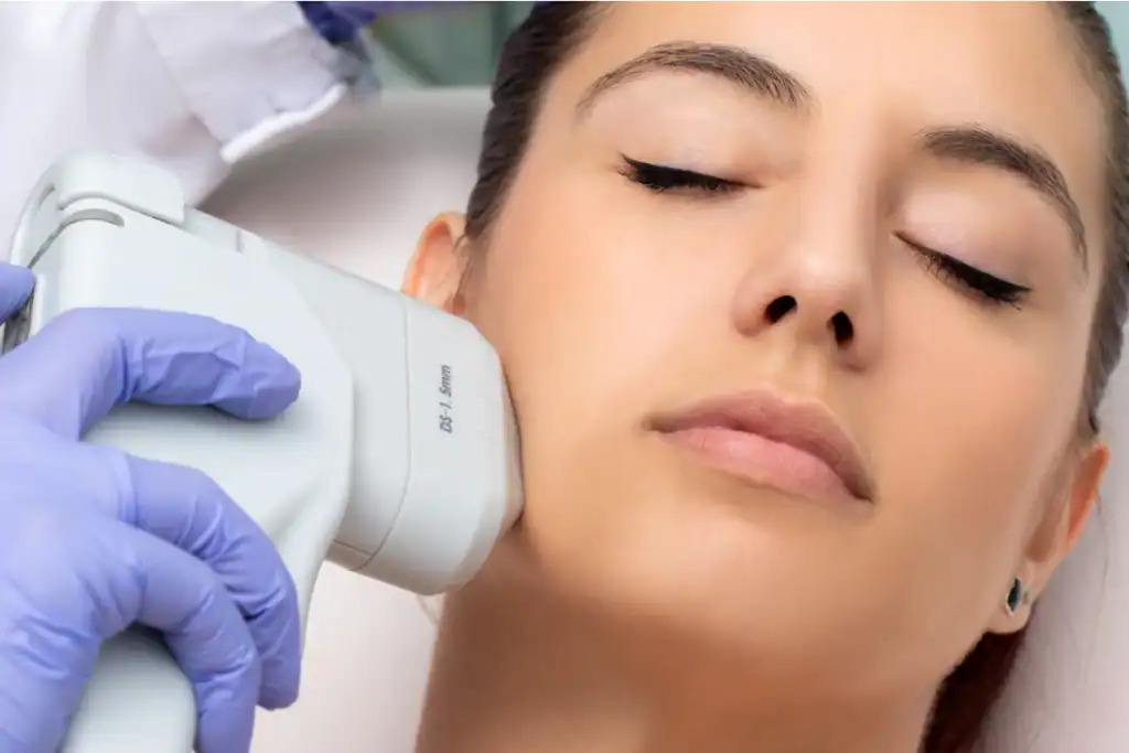 Discover the Perfect Duo: RF Microneedling and HIFU 2 Image of Morpheus8 And HIFU Combined with Lipo 360 Nazeing